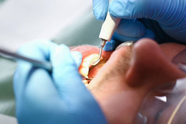 Best Urgent Care for Lost Fillings or Crowns in Graham, TX