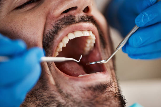 Best Cosmetic Emergency Dentistry in Graham, TX